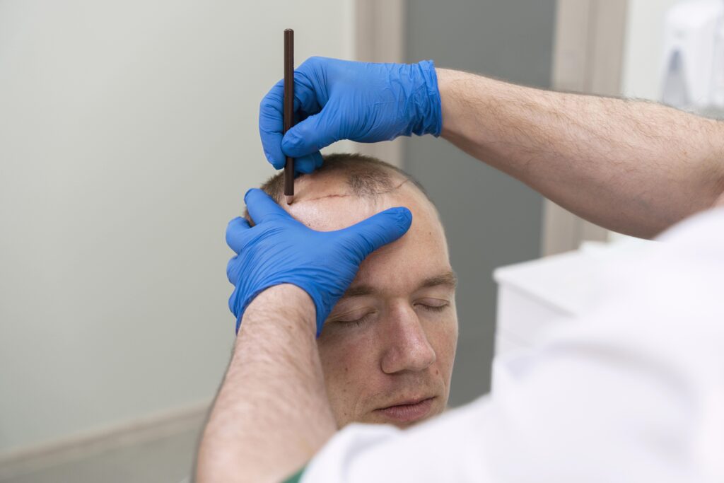 mature man having balding problems